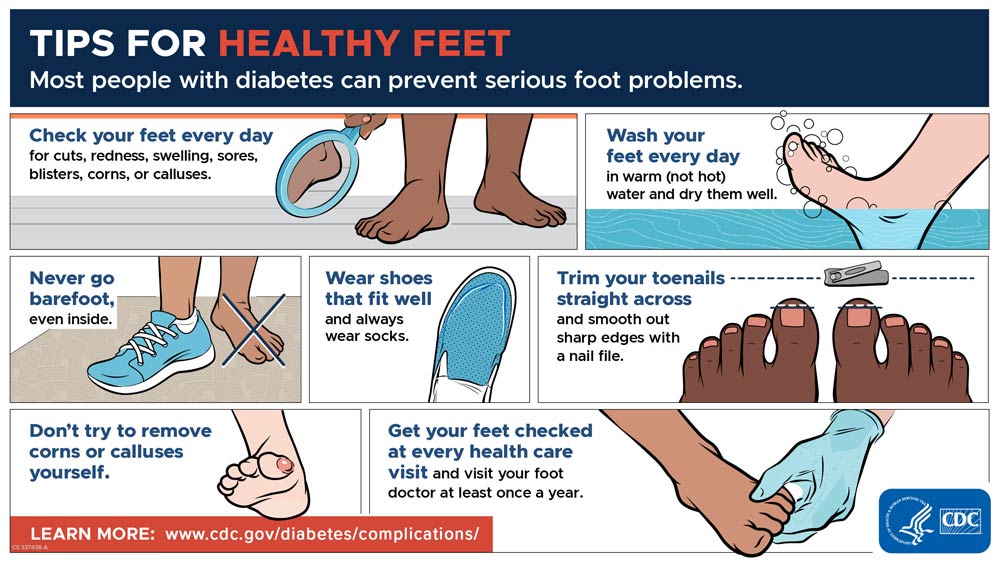 Footcare Tips Footcare Tips